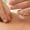 Discover the Benefits of Acupuncture for Sleeplessness in Portland