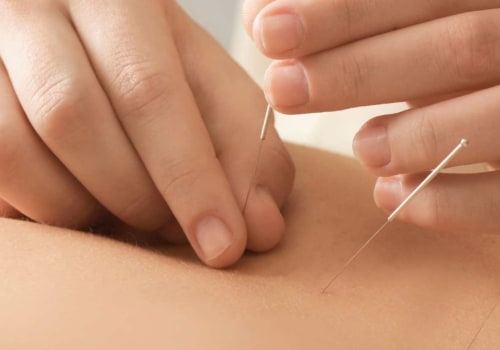 Discover the Benefits of Acupuncture for Sleeplessness in Portland